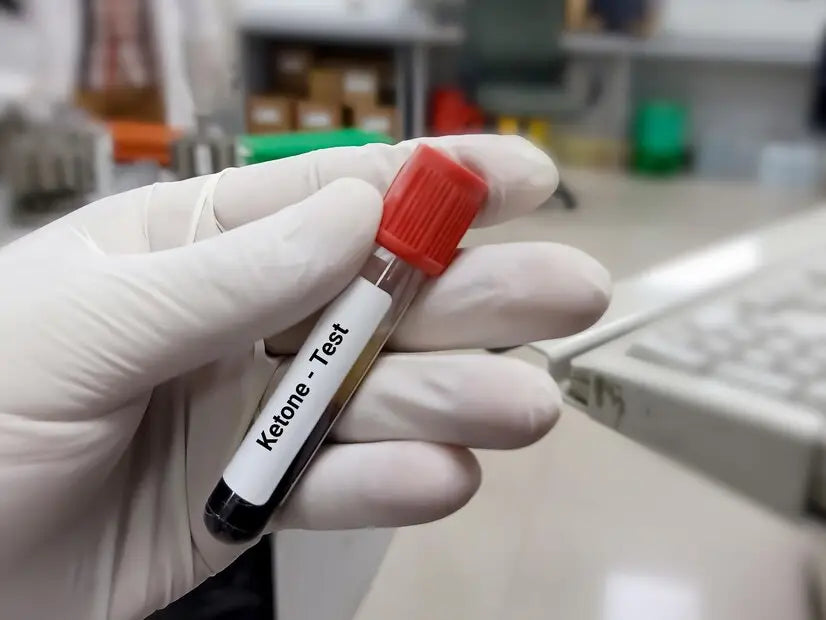 Diabetic Ketoacidosis: A Complete Guide For Individuals With Diabetes Imagen