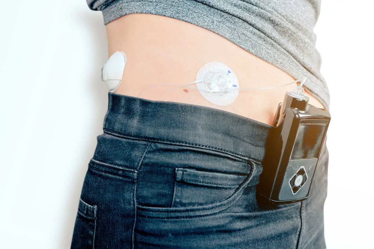The Closed-Loop System for Diabetes Imagen