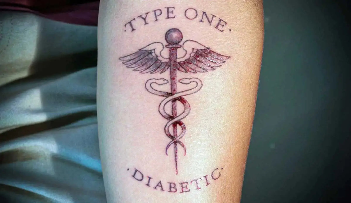 type 1 diabetic with a tattoo on the forearm  Imagen
