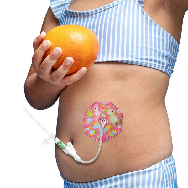 Protectores de gastrostomía para niños – Diseños coloridos y confort suave | Kaio-Tube Pads